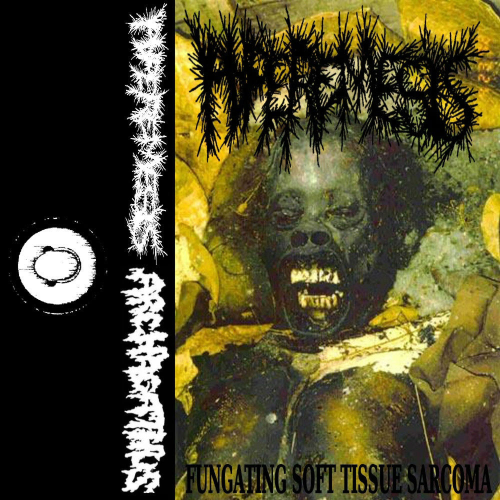 Hyperemesis - ARCHAGATHUS SPLIT OFFICIAL: quando il grind incontra la storia della medicina